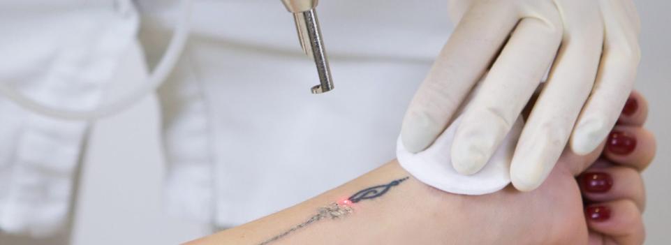 ND YAG Laser Machine