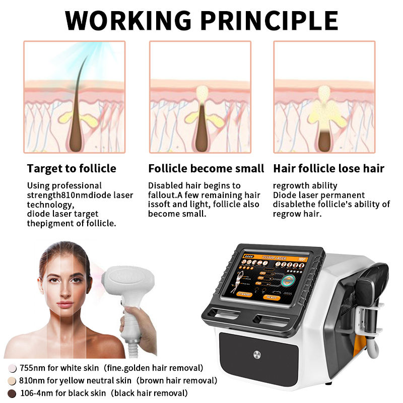 1064nm/755nm/810nm Diode Laser Body Hair Removal Permanent Machine Body & Facial
