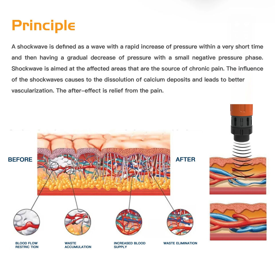 Equine Shock Wave Therapy Machine Animal Pet Physiotherapy Wounds HealingTherapy