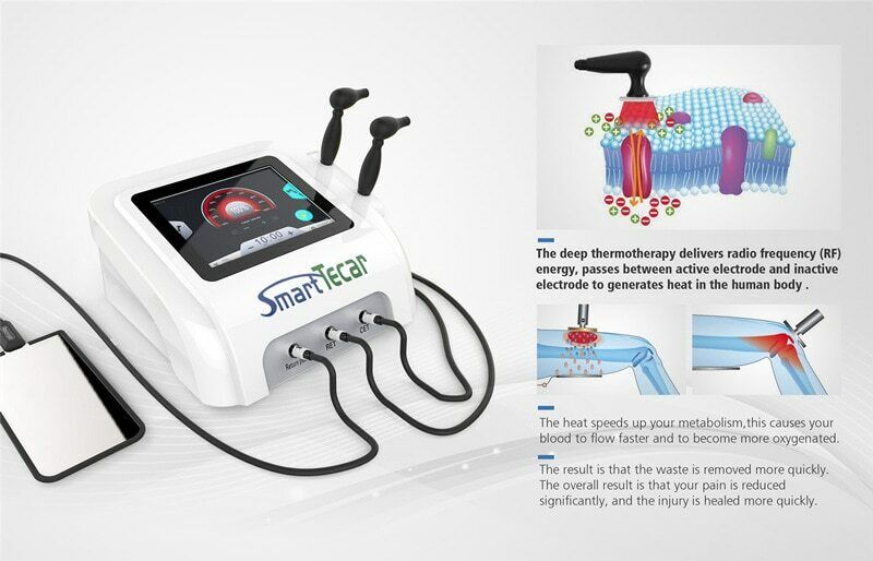 Physio Rehabilitation Sport Injury Recovery With CET RET Radio Frequency