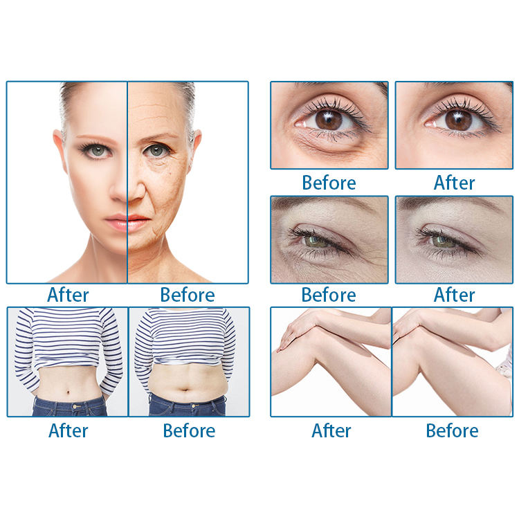 New Arrival 2 In 1 Portable Hifu 7d Hifu Vaginal Tightening Face Lifting Machine