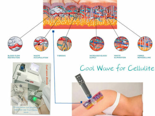 2 in 1 Cold Freezing Body Slimming Shock Wave Full Body Pain Relieve Massage