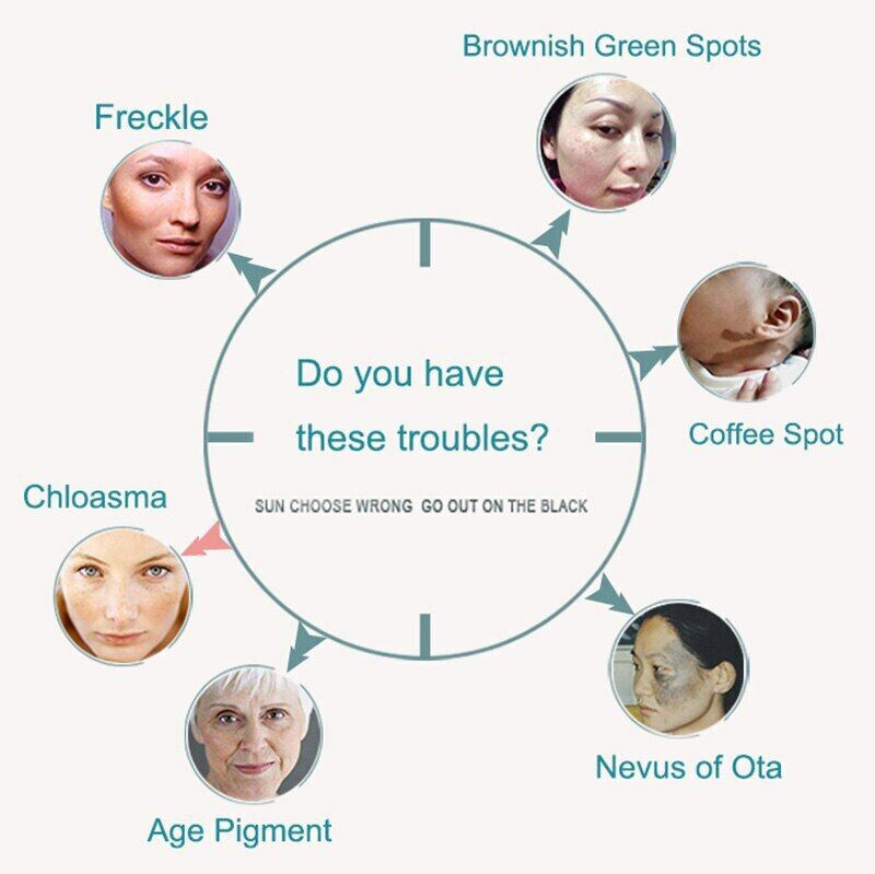 Picosecond Laser Tattoo Removal Machine Pico Laser Skin Rejuvenation Pigment