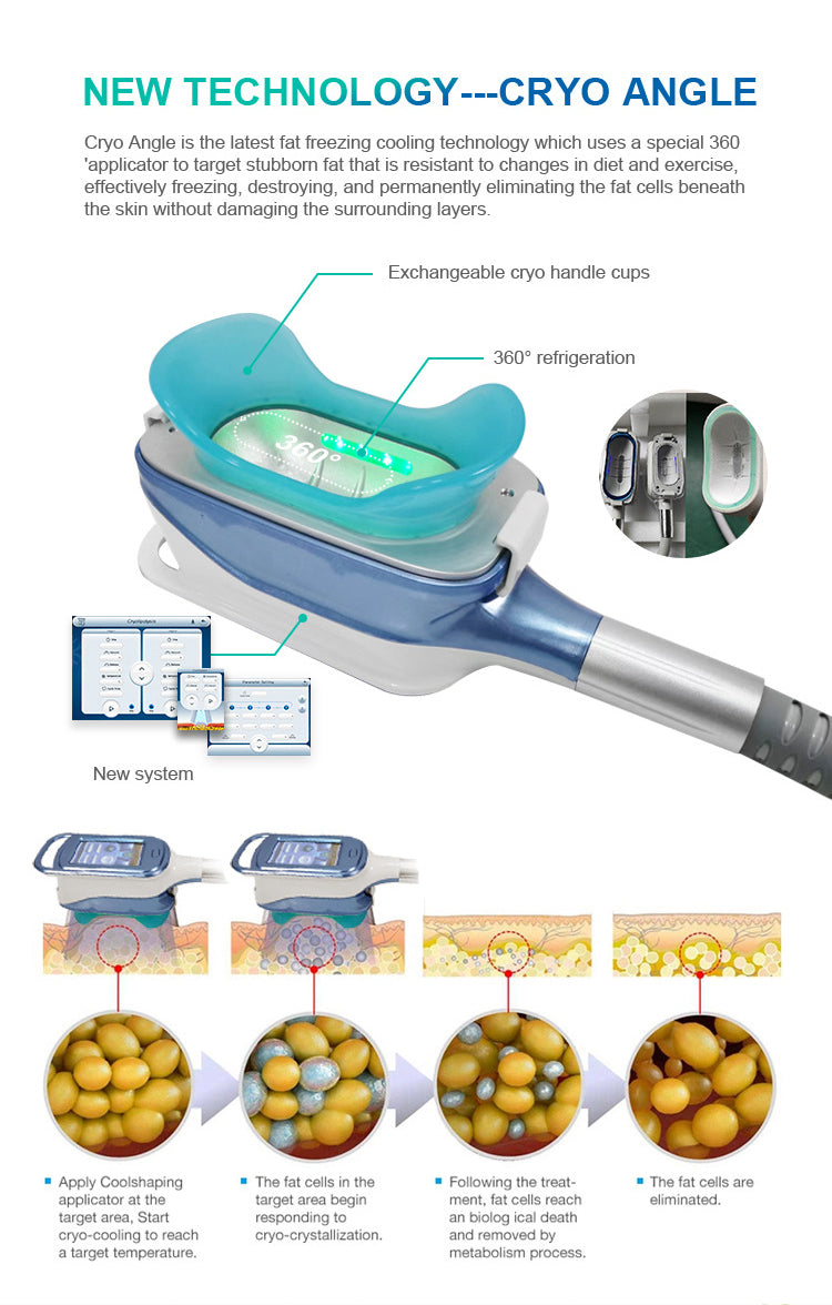 360 Degree Fat Cryo Freezing Sculpting Machine Cavitation RF Slimming Equipment